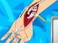খেলা Arm surgery 2