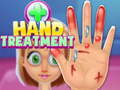 খেলা Hand Treatment