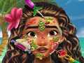 খেলা Moana Skin Doctor