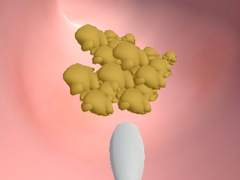 খেলা Earwax Clinic